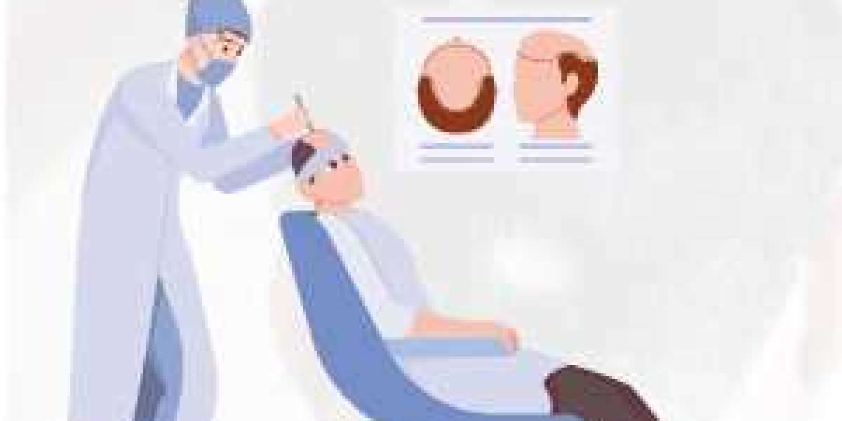 Alopecia Treatment Market Analysts Expect Robust Growth In 2029