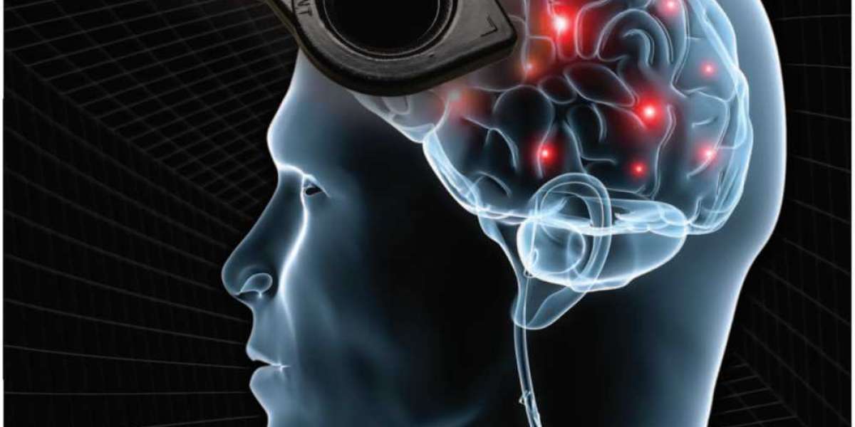 Non-invasive Brain Stimulation System Market, analysis Industry Analysis, Opportunity Assessment And Forecast Upto 2031